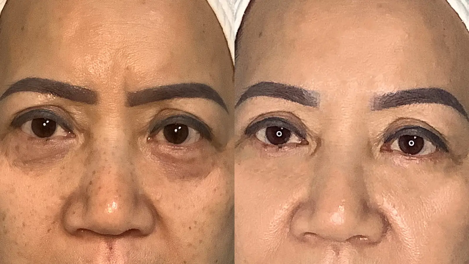 Makeup-Removal-16x9-RT