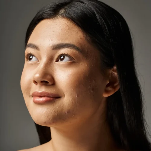 dreamy young asian woman with skin issues and bare shoulders looking up on grey background