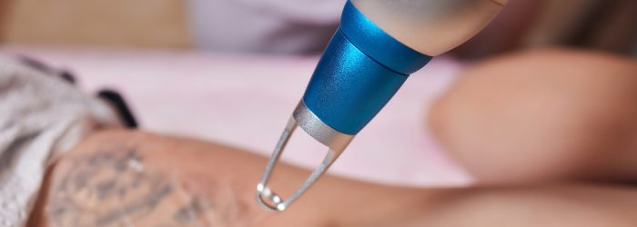 Young woman undergoing laser tattoo removal procedure in salon, closeup